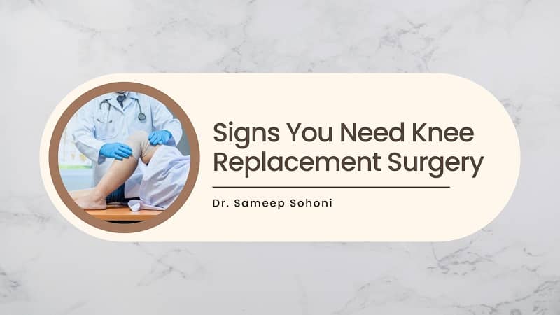 Signs You Need Knee Replacement