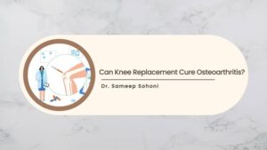 Can Knee Replacement Cure Osteoarthritis