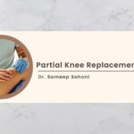 Partial Knee Replacement