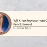 Will Knee Replacement Correct Knock Knees