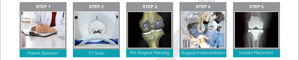 Robotic Joint Knee Replacement process