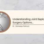 Understanding Joint Replacement Surgery Options and Choosing the Right One for You