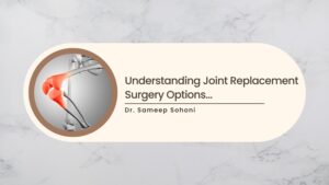 Understanding Joint Replacement Surgery Options and Choosing the Right One for You