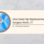 how does hip replacement surgery work