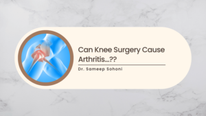 Can Knee Surgery Cause Arthritis