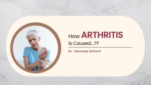How Arthritis is Caused