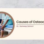 Causes of Osteoarthritis