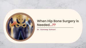 When Hip Bone Surgery is Needed