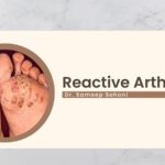Reactive Arthritis