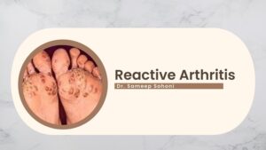 Reactive Arthritis