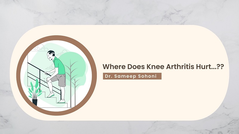 Where Does Knee Arthritis Hurt