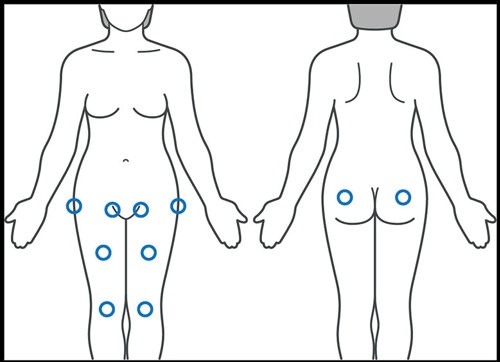 Areas of your body where hip pain can be felt