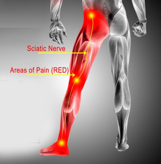 what causes hip pain that radiates down the leg