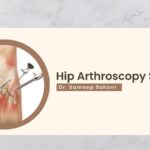 Hip Arthroscopy Surgery