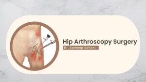 Hip Arthroscopy Surgery